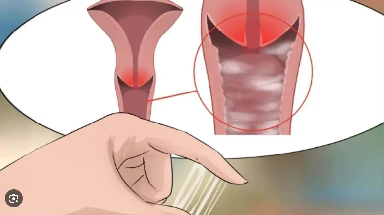 Hút thai được 1 tuần quan hệ có sao không? Có thể có thai không? Thuốc  Phá  Thai  Tại  Nga  .
