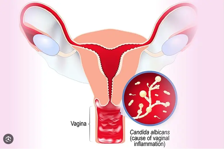 Cách quan hệ không bị viêm nhiễm, quy tắc mà phụ nữ không nên bỏ qua . Thuốc  Phá Thai Tại Trung Quốc .