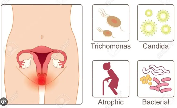 Cách vệ sinh vùng kín đúng cách cho tuổi dậy thì . Thuốc  Phá  Thai  Tại  Trung  Quốc  .