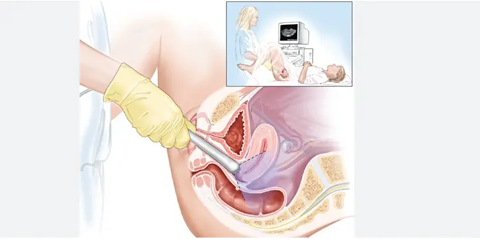 Bệnh  thiếu  máu  bẩm  sinh  nguyên  nhân  triệu  chứng  và  cách  phòng  ngừa  . Thuốc  Phá  Thai  Tại  Nga  .